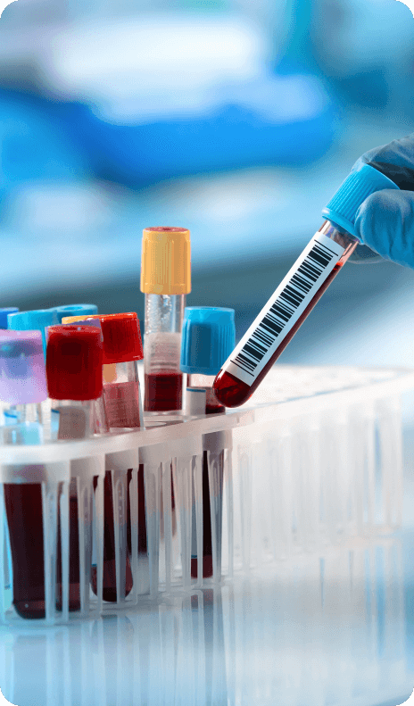 Blood sampling lab image